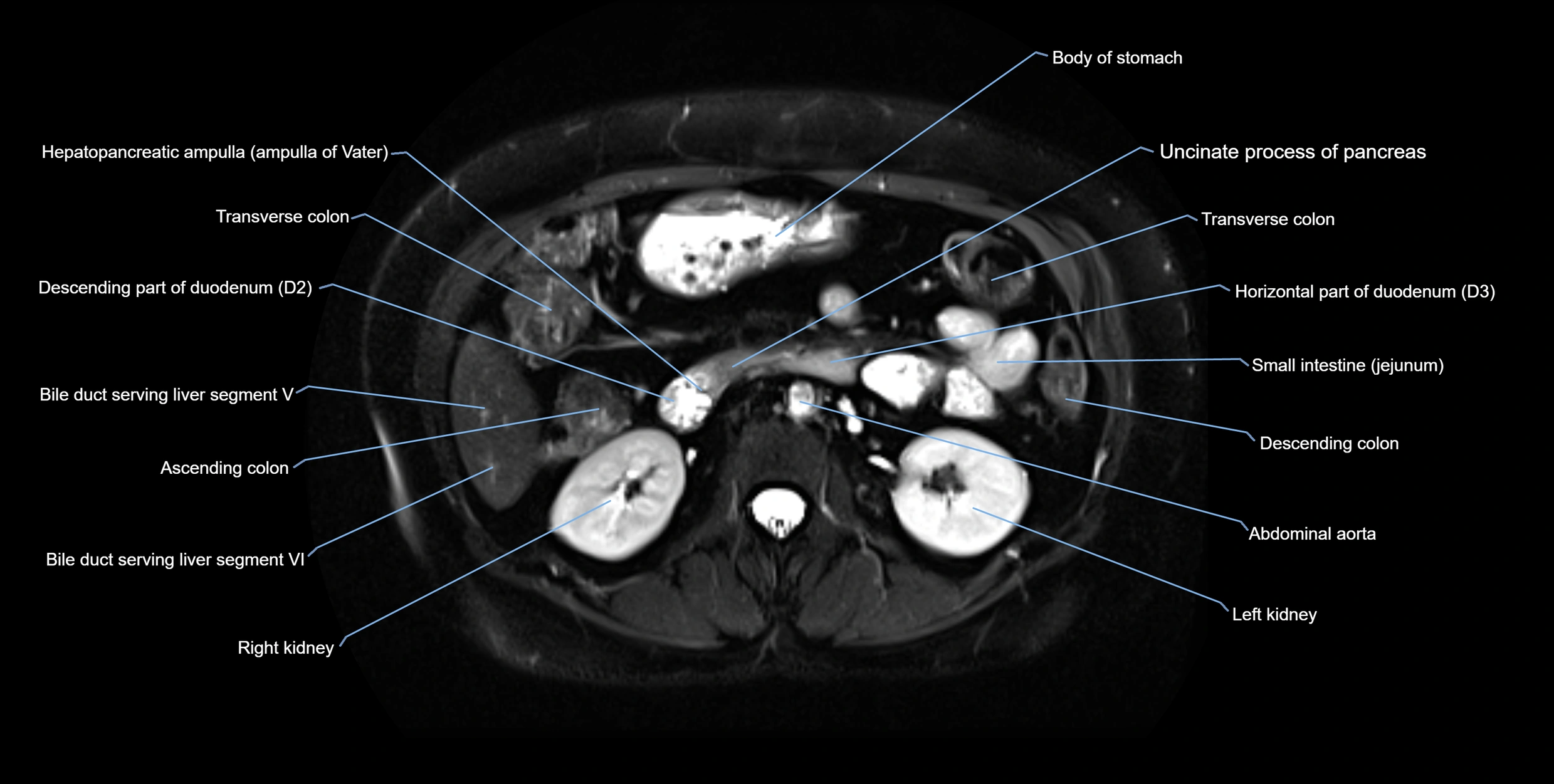 MRI MRCP axial cross sectional anatomy 3T radiology  image-img-10001-00029.webp